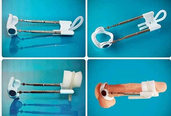 extender to thicken the penis