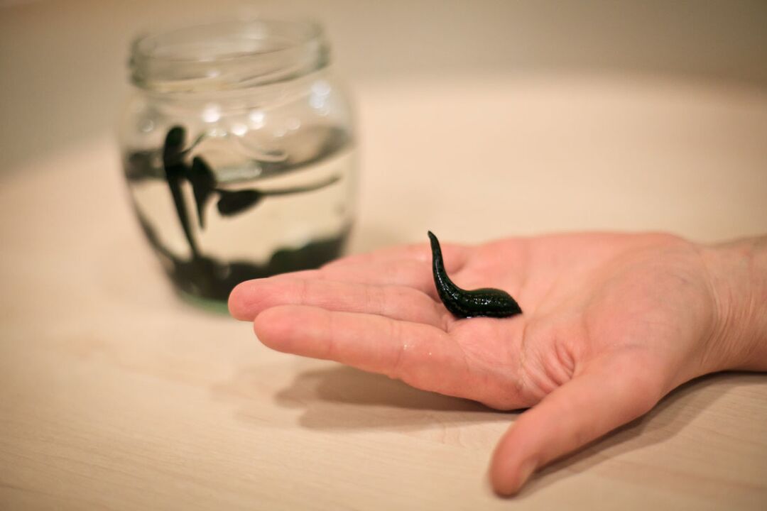 The leeches will serve as raw material for the production of a cream that stimulates penis growth.